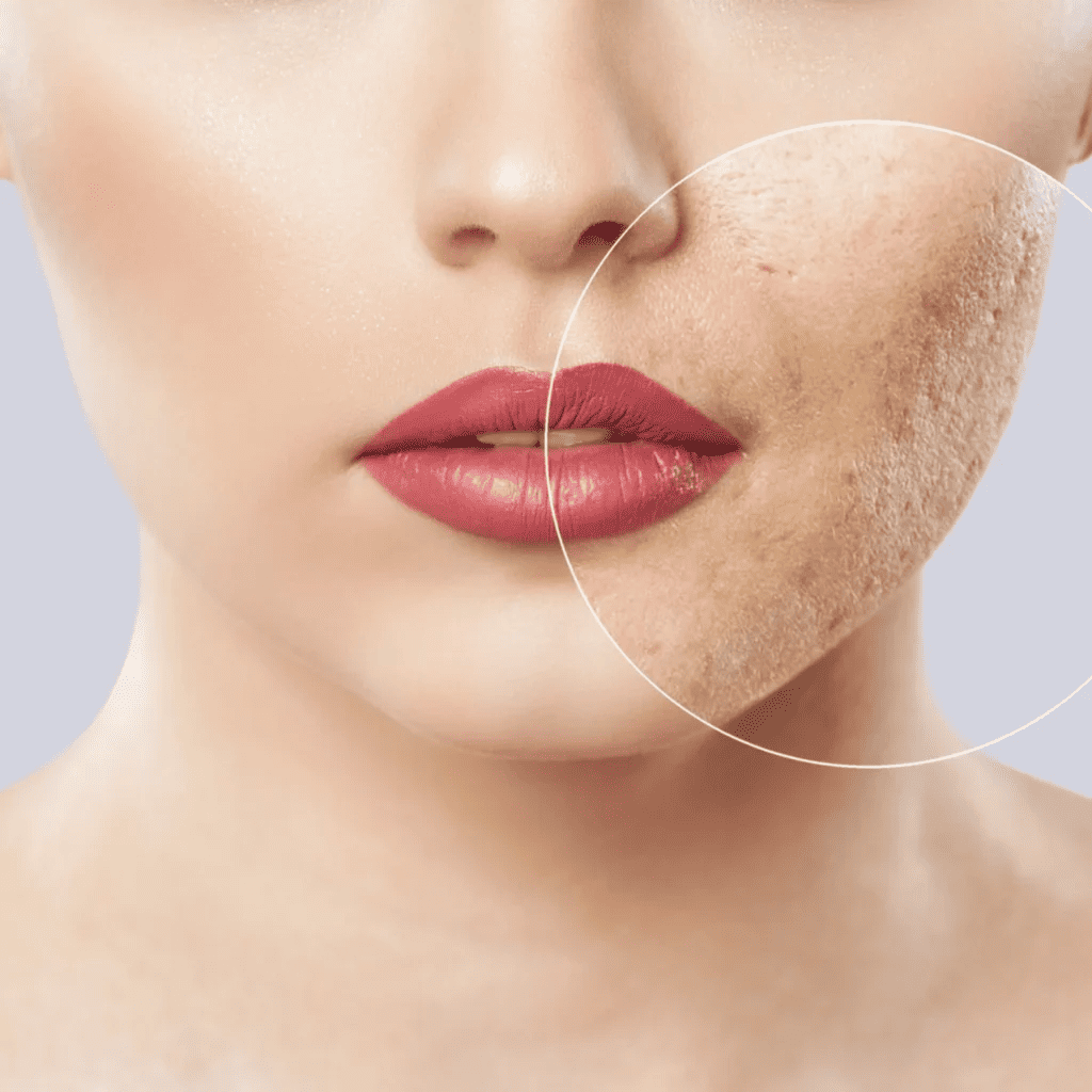 A Med - Dermapen Beograd