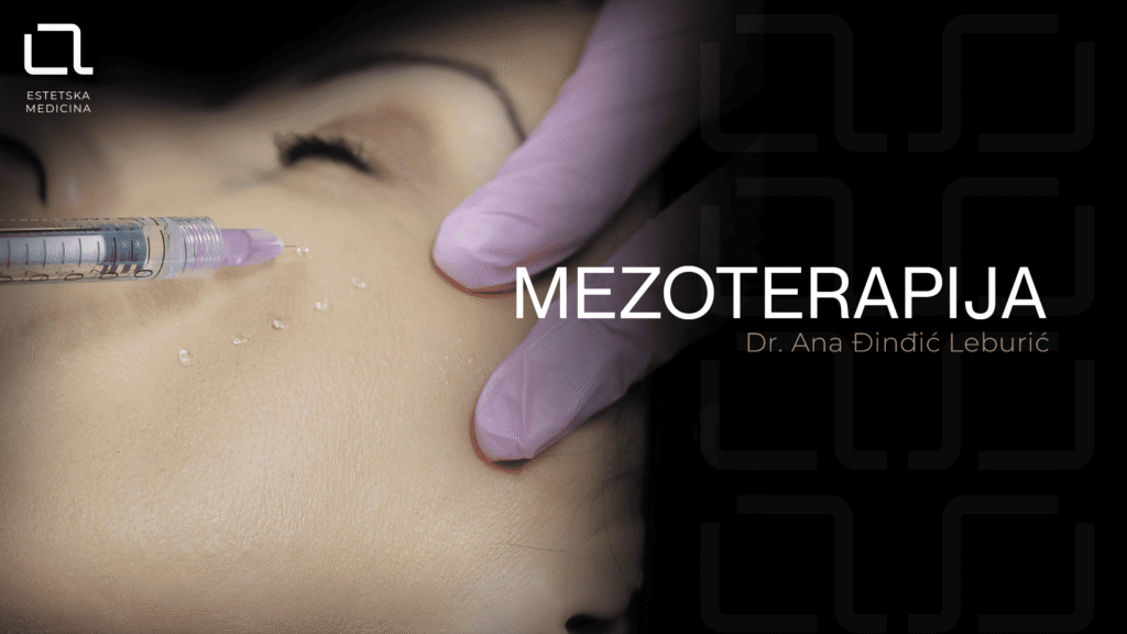 Mezoterapija lica – dr Ana Đinđić Leburić, A Med Beograd Prikaz mezoterapije lica — ubrizgavanje koktela tankim iglicama u A Med ordinaciji u Beogradu