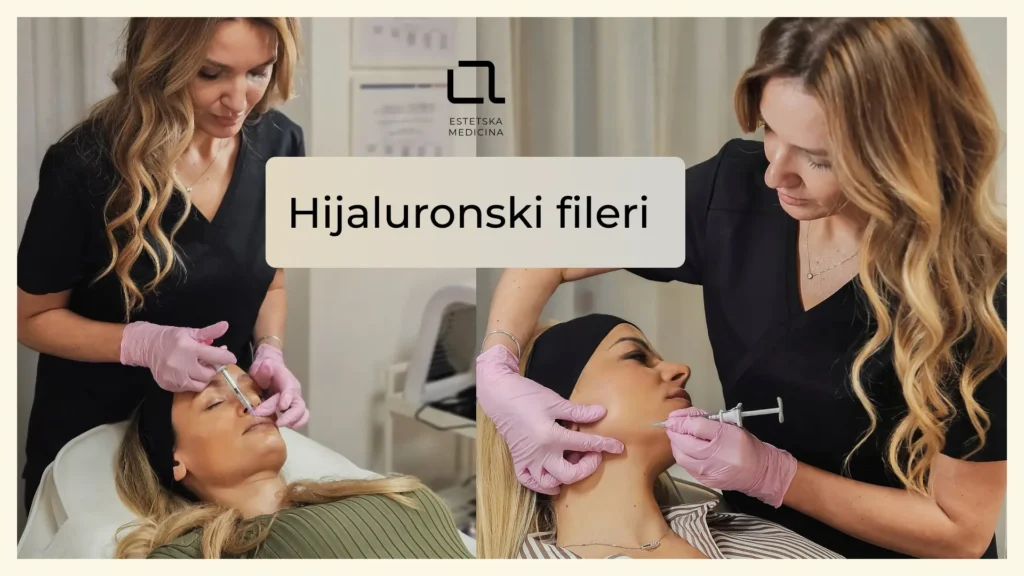 Žensko lice sa označenim tačkama primene hijaluronskih filera
