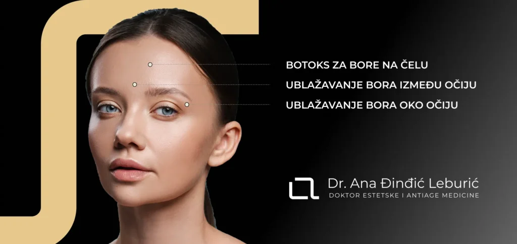 Regije na licu za primenu botoksa – čelo, bore između obrva, područje oko očiju i uglovi usana