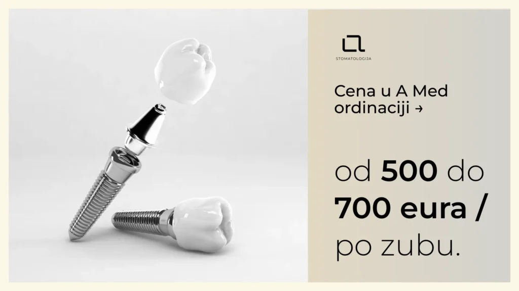 Zubni implantat sa jasno istaknutom cijenom kao ilustracija troškova ugradnje.