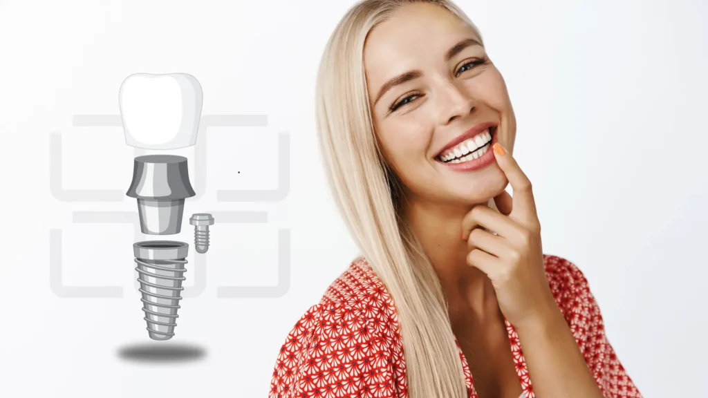Savršeni osmeh sa ugrađenim zubnim implantatima koji izgledaju kao prirodni zubi.