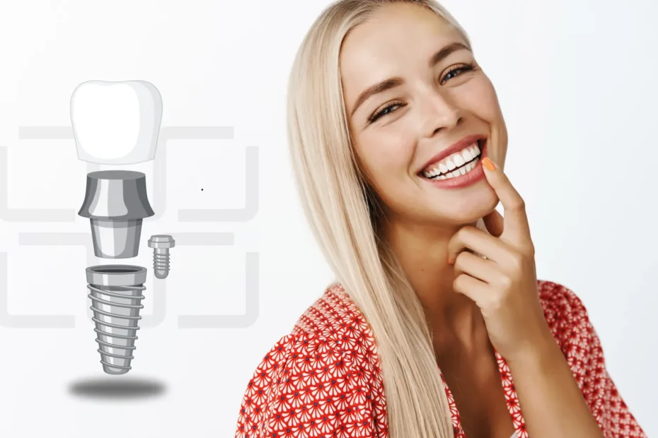 Savršeni osmeh sa ugrađenim zubnim implantatima koji izgledaju kao prirodni zubi.