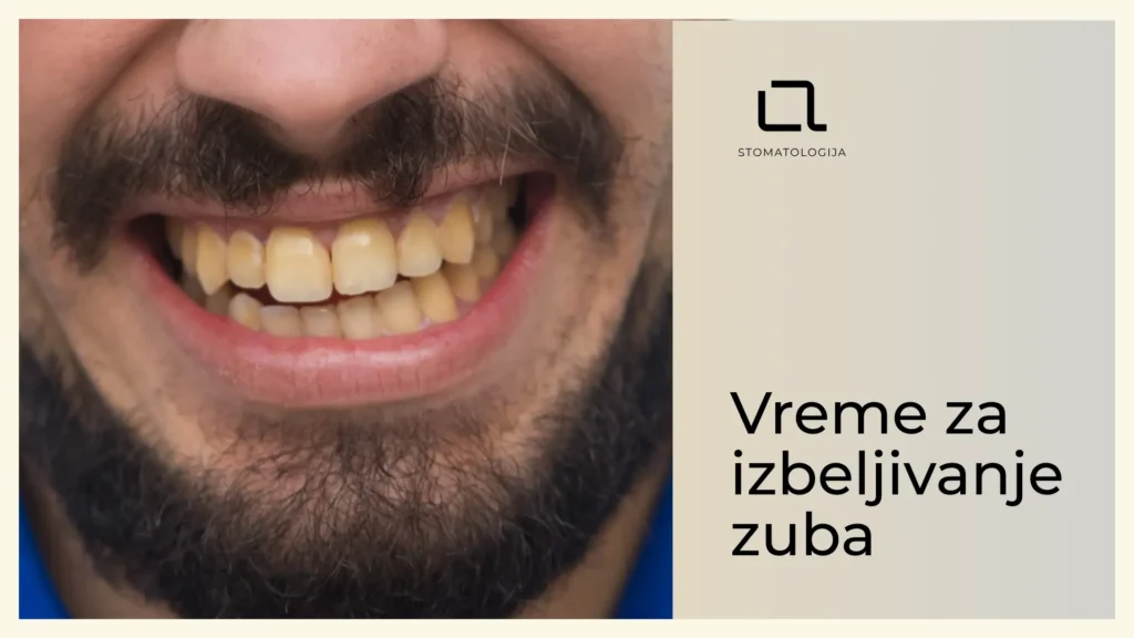 Ako primetite da su vam zubi žućkasti ili da su dobili tamnije mrlje vreme je da razmislite o izbeljivanju zuba.