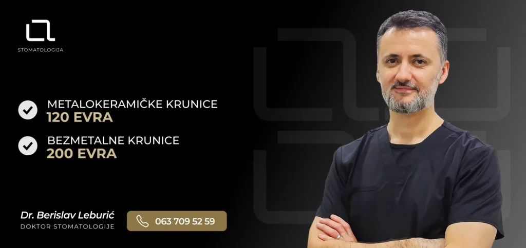 krunice za zube cena i